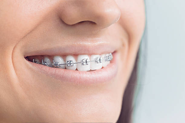 Best Dentures (Full and Partial)  in Palm Bay, FL